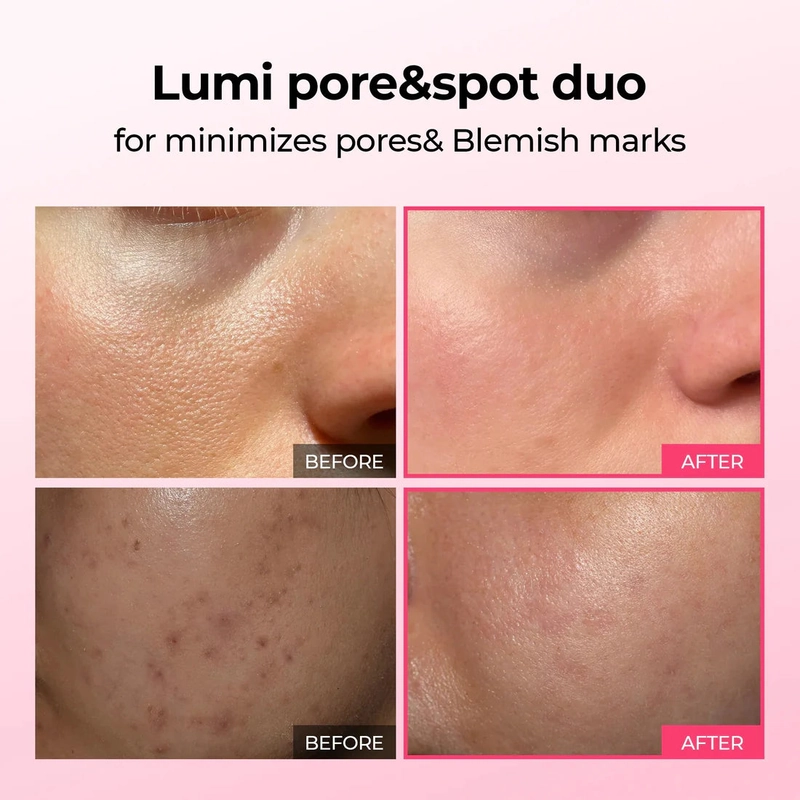 Dr. Melaxin Rice Peel Shot – Exfoliating Rice Serum Ampoules for Glow