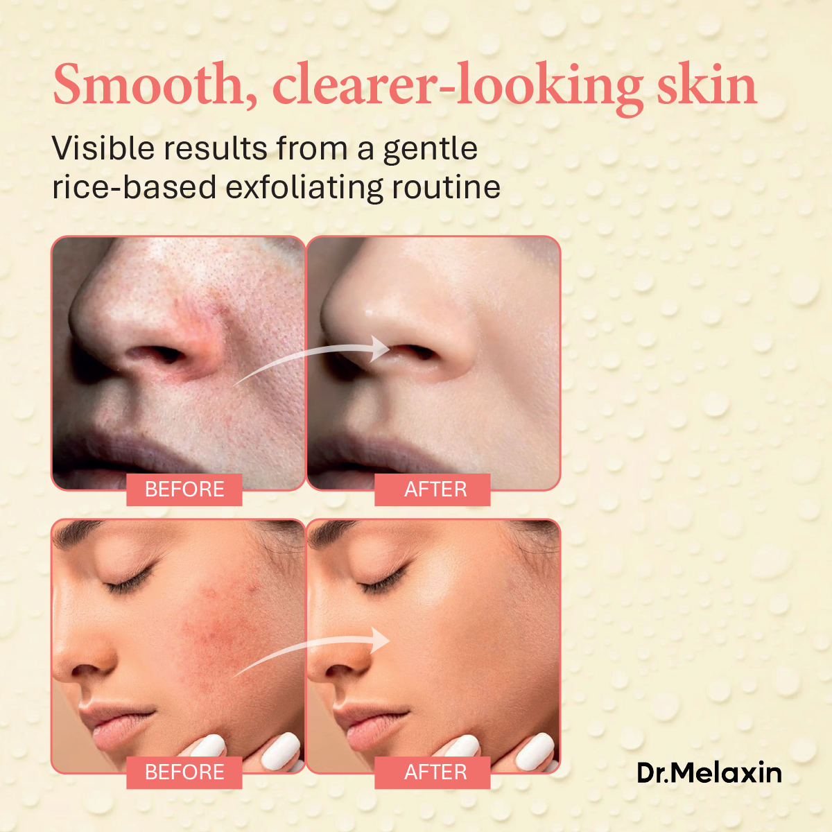 Dr. Melaxin Rice Peel Shot • Exfoliating Rice Serum Ampoules for Glow